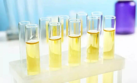 Men’s health can be seen from morning urine